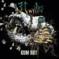 Gum rot | 13 Cavities